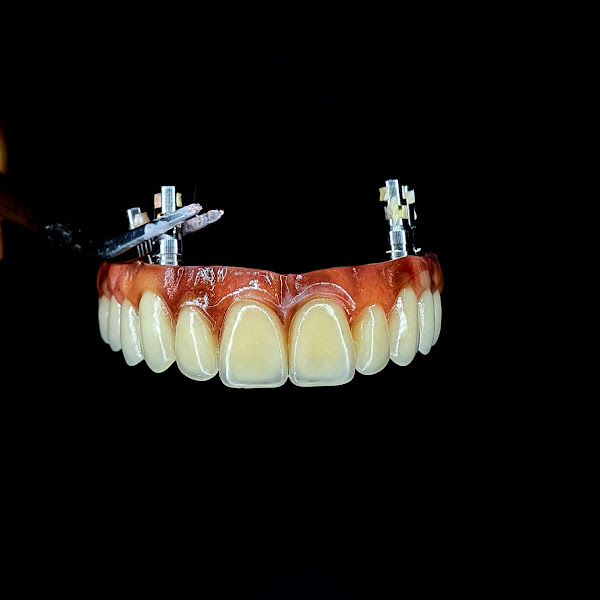 Foto 3 de LS soluções protéticas carga imediata