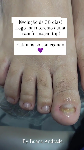 Foto 3 de Luana Andrade Podologia e Estética