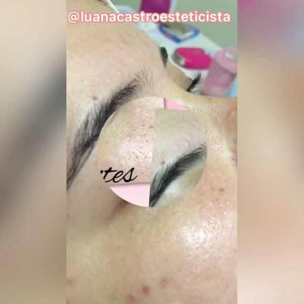 Foto 3 de Luana Castro Estética e Bem estar