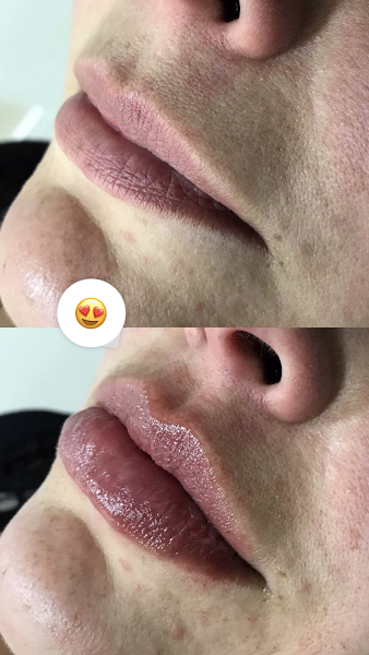 Foto 3 de Luana Fontoura