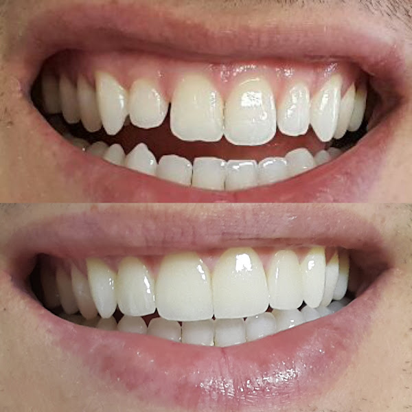 Foto 2 de Lucas Lahr Odontologia