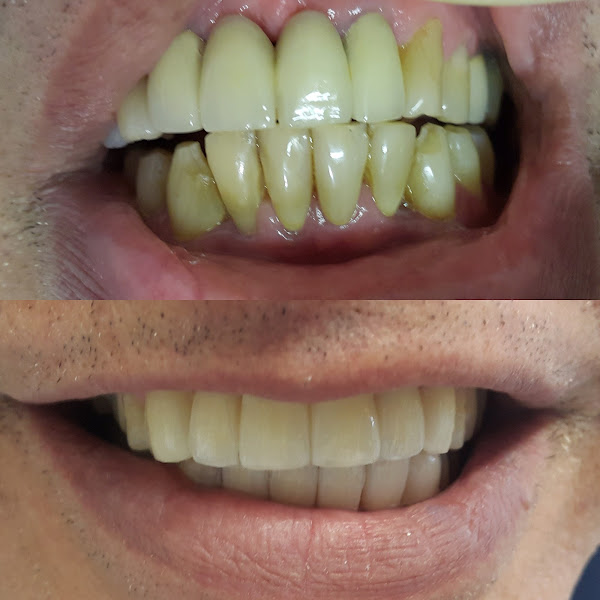 Foto 3 de Lucas Lahr Odontologia