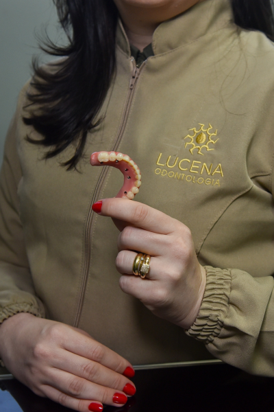 Foto 2 de LUCENA Odontologia - Prótese Protocolo e Implante em Teresina - Lente de contato dental em Teresina