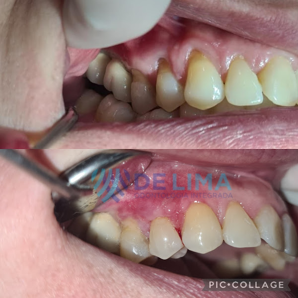 Foto 2 de Luciana de Lima - Cirurgiã Dentista