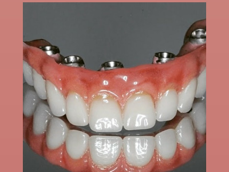 Foto 2 de Luciana Garcia Coelho Cirurgiã Dentista