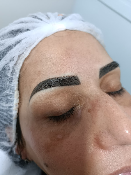 Foto 3 de Luciana Moreira Afeto Clinica- Interlagos - Especialista Micropigmentação Capilar -Lábios-Sobrancelhas (Fio a fio), Depilação