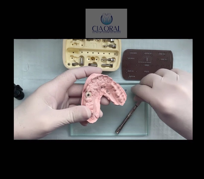 Foto 3 de Luciano Siqueira implantodontista Protesista Odontologia Estética Implantes Dentários Coroas Sobre Implante Facetas em Natal