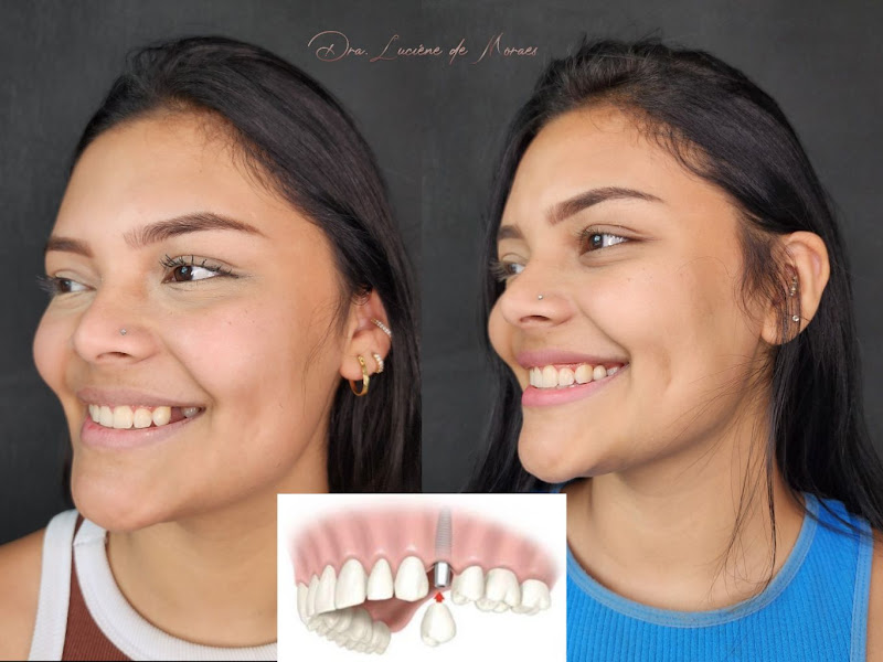 Foto de Luciene de Moraes. Implantes, estética y harmonização orofacial.