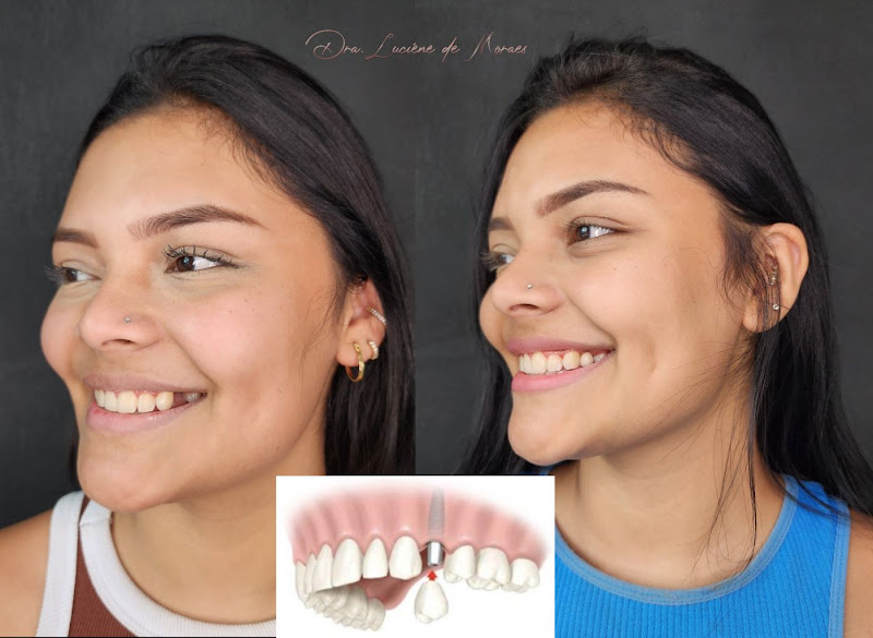 Foto 2 de Luciene de Moraes. Implantes, estética y harmonização orofacial.