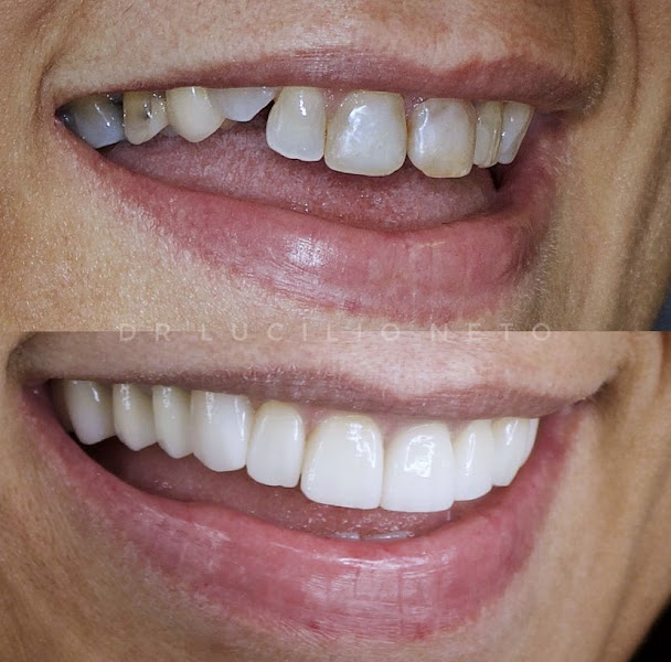 Foto 2 de Lucilio Neto Odontologia