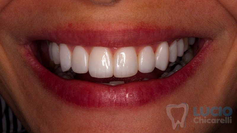 Foto 2 de Lucio Chicarelli - Cirurgião Dentista