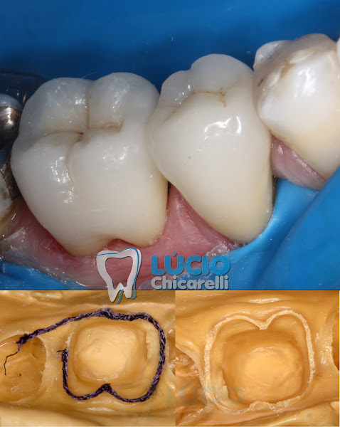 Foto 3 de Lucio Chicarelli - Cirurgião Dentista