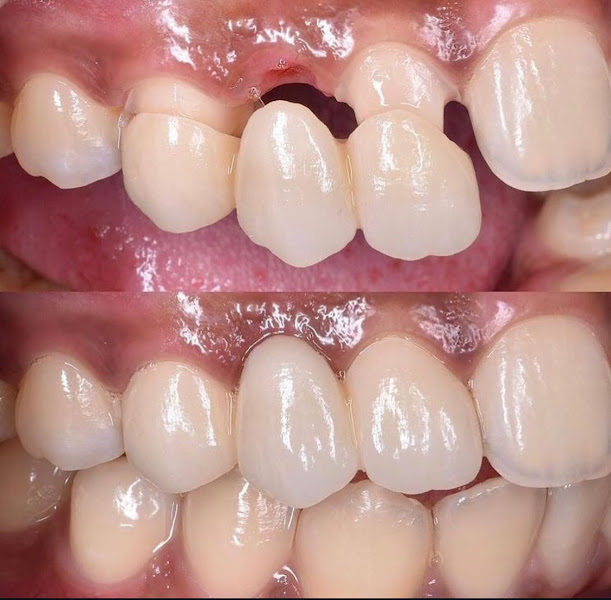 Foto 3 de Ludmila Mariano Odontologia Integrada