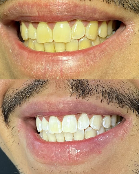 Foto 3 de Ludmilla Bernardes | dentista em Anápolis