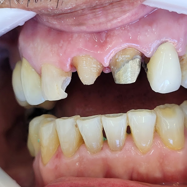 Foto 2 de Luiz Carlos Regenin