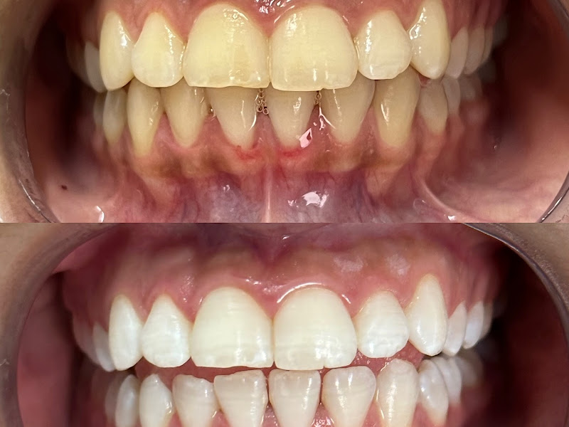 Foto 6 de Luiza Belo Clínica Odontológica