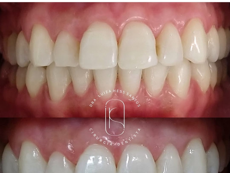 Foto 6 de Luiza Rigotti Odontologia