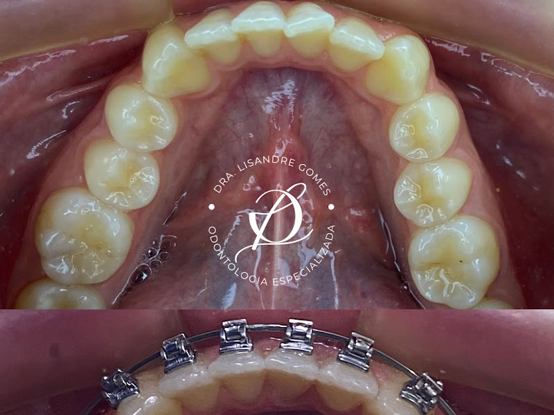 Foto 3 de Luize Anjos