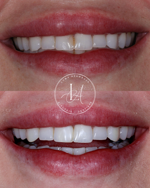 Foto 3 de Luma Azambuja | Dentista em Santa Cruz do Sul