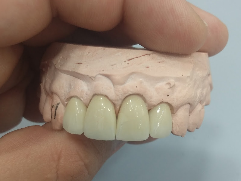 Foto 6 de LUME Sorrisos Personalizados -Nova Iguaçu