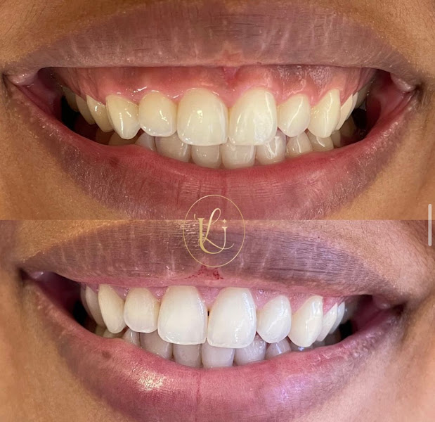 Foto 2 de Lumière Odontologia Especializada