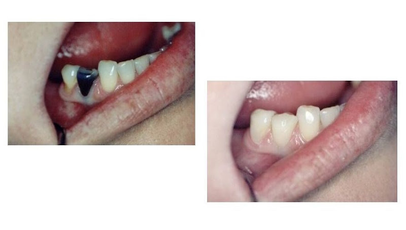 Foto 3 de Lumine Odonto / Reabilitação Estética & Clínica Geral