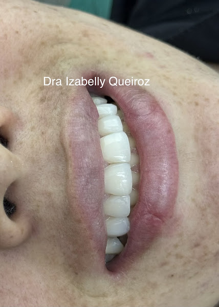 Foto 2 de Lumiza Odontologia