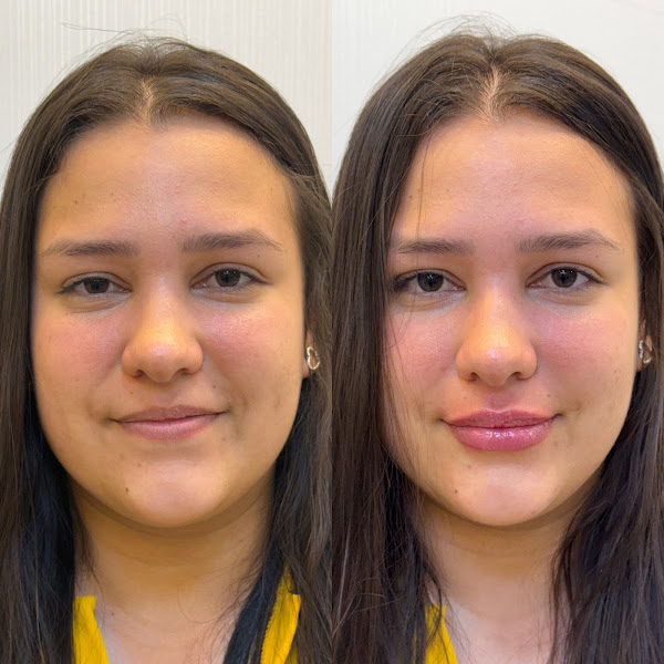 Foto 3 de LUV Instituto de Estetica Avançada