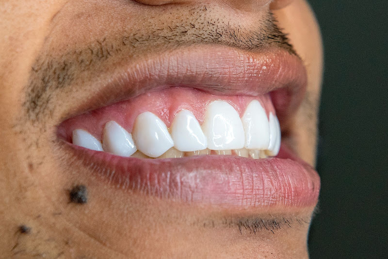 Foto 2 de Lux Estética Odontológica