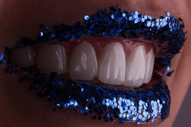 Foto 2 de Lux Estética Odontológica - Referência em Facetas em Resina - Alphaville