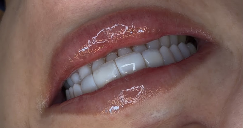 Foto 3 de Lux Estética Odontológica - Referência em Facetas em Resina - Guarulhos