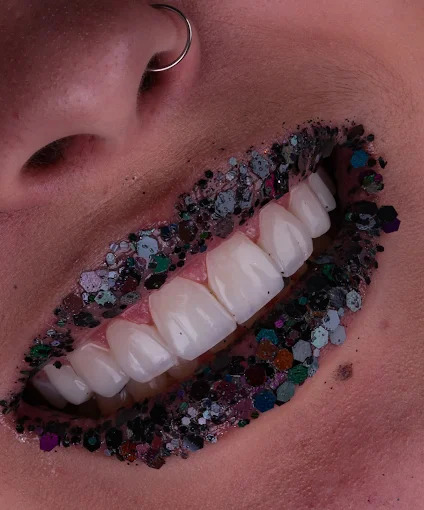 Foto 3 de Lux Estética Odontológica - Referência em Facetas em Resina - Jundiaí