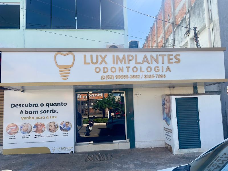 Lux Implantes Odontologia