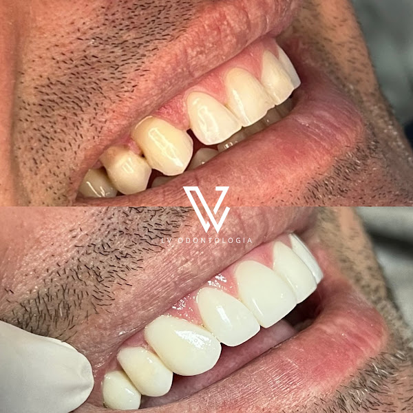 Foto 3 de LV Odontologia