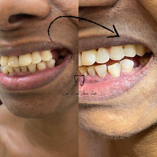 Foto 2 de LVI Odontologia