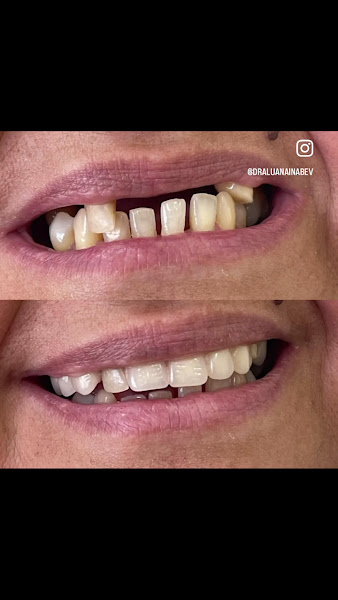 Foto 3 de LVI Odontologia