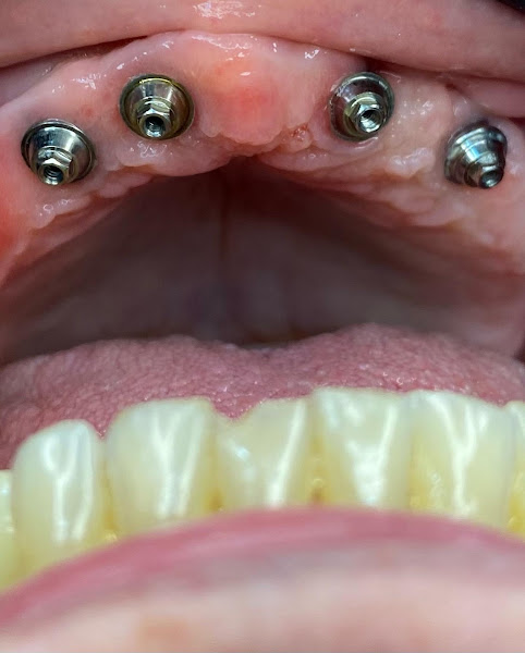 Foto 3 de M&C IMPLANTES clínica odontológica