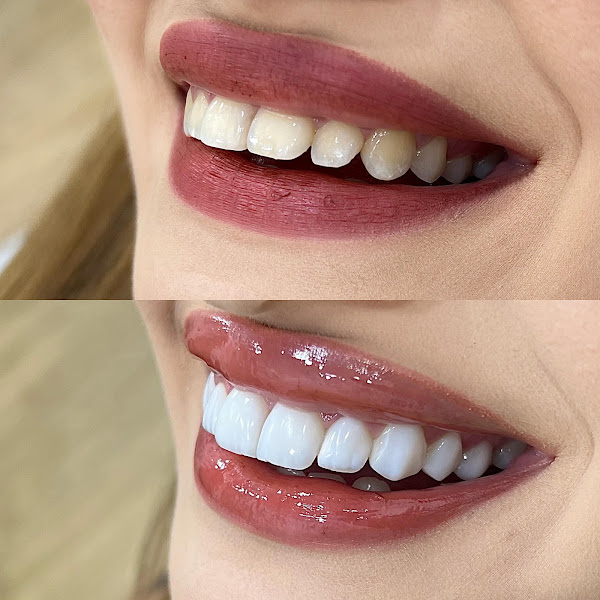 Foto 2 de M.C ODONTOLOGIA ESTÉTICA LTDA