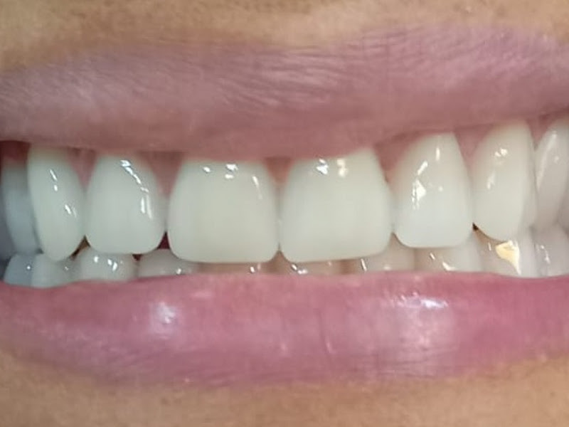 Foto 3 de M.O. Odontologia Especializada Dr. Édson Ary de Oliveira