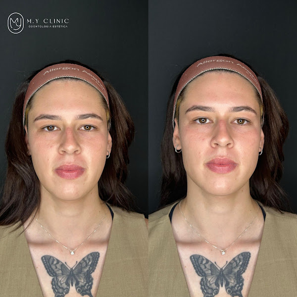 Foto 3 de M.Y Clinic Odontologia Estética Ltda