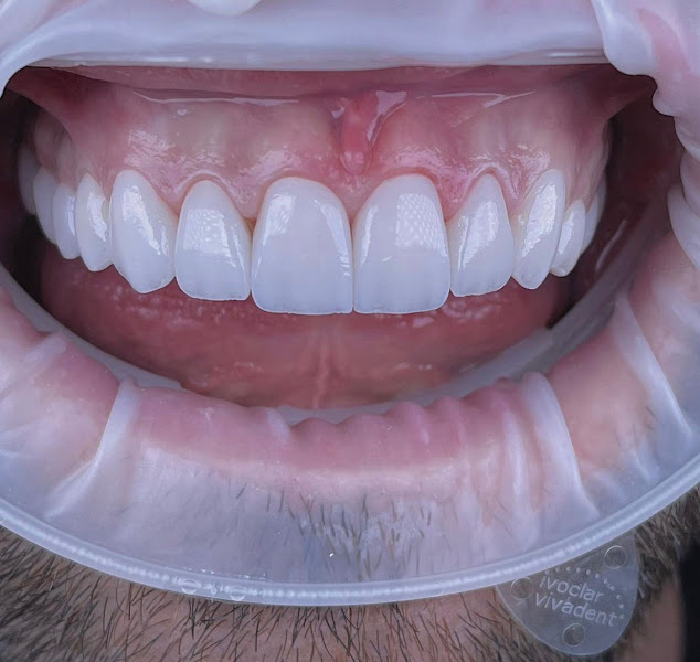 Foto 2 de MA LAB PREMIUM LABORATÓRIO DE PRÓTESE DENTLA