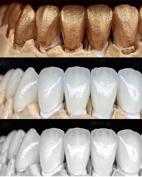 Foto 3 de MA LAB PREMIUM LABORATÓRIO DE PRÓTESE DENTLA