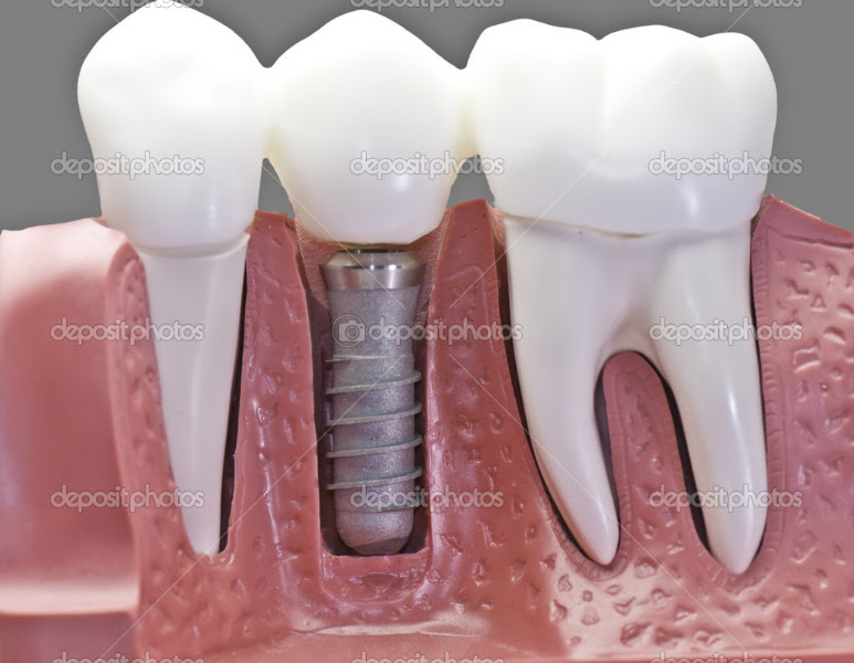Foto 3 de Machado Odonto | DENTISTA TERESINA
