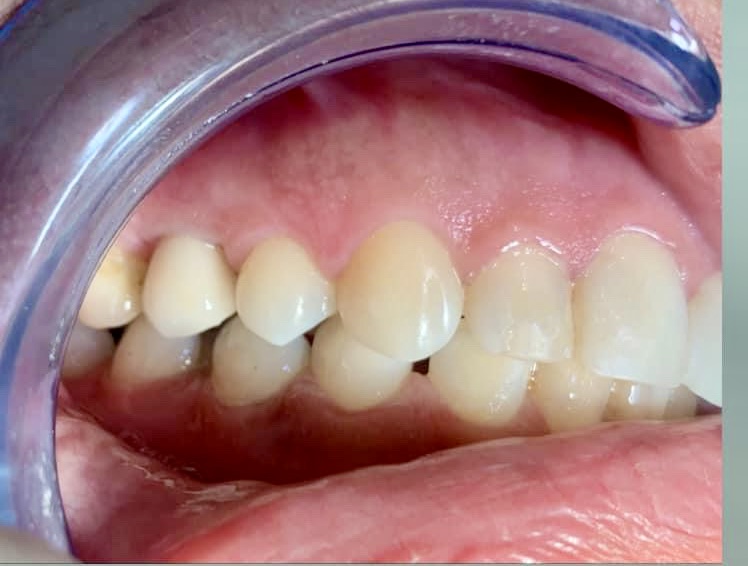 Foto 2 de Magalhães Odontologia - Dentista, Protético e Prof. de Prótese, implante - RT Renato Magalhães Cro-RJ 49940 - EPAO 6602