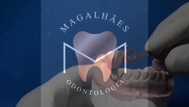 Foto 3 de Magalhães Odontologia - Dentista, Protético e Prof. de Prótese, implante - RT Renato Magalhães Cro-RJ 49940 - EPAO 6602