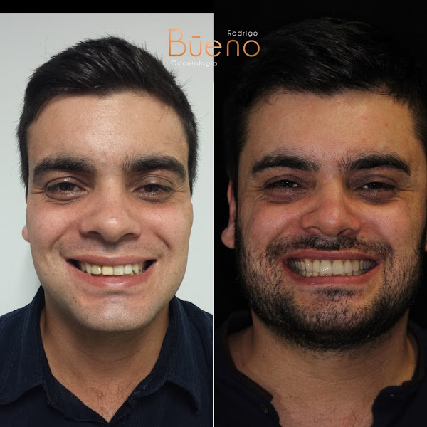 Foto 3 de Magáli Guimarães e Rodrigo Bueno - Odontologia | Reabilitação Oral | Odontogeriatria