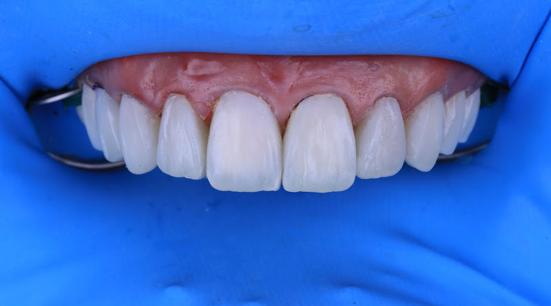 Foto 2 de Maica Odontologia Campo Limpo