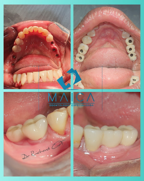 Foto 3 de Maica Odontologia Campo Limpo