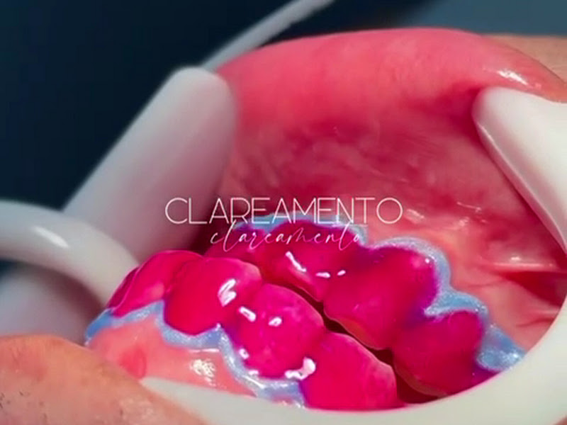 Foto 5 de MAIS DENT - ODONTOLOGIA E ESTÉTICA FACIAL