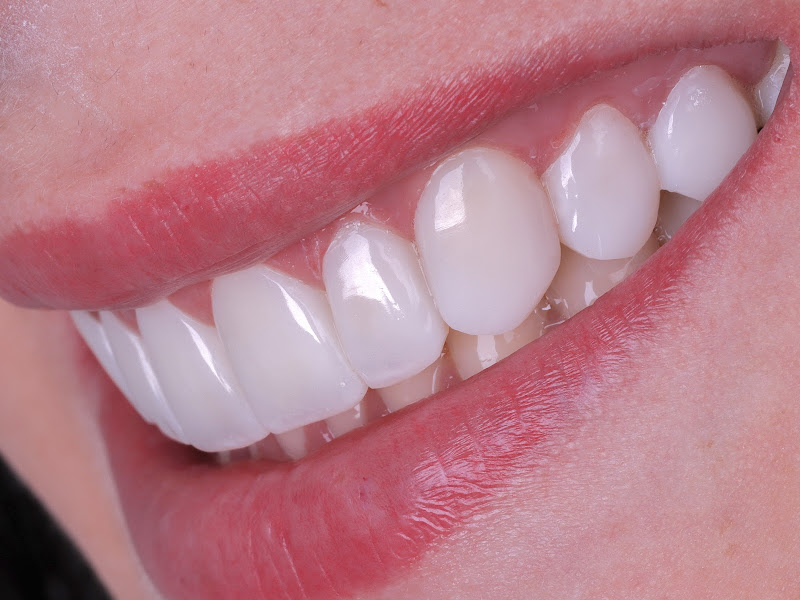 Foto 2 de Mais Odonto Barbacena